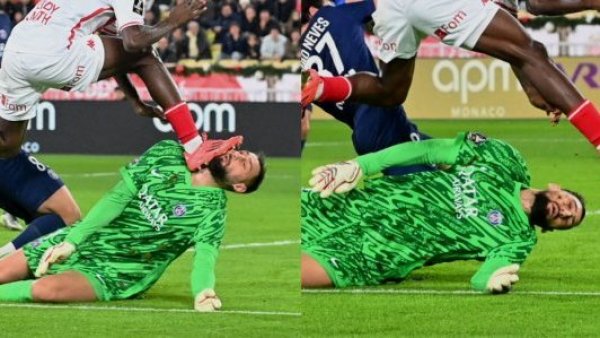 Revelan imágenes del rostro de Gianluigi Donnarumma tras brutal patada
