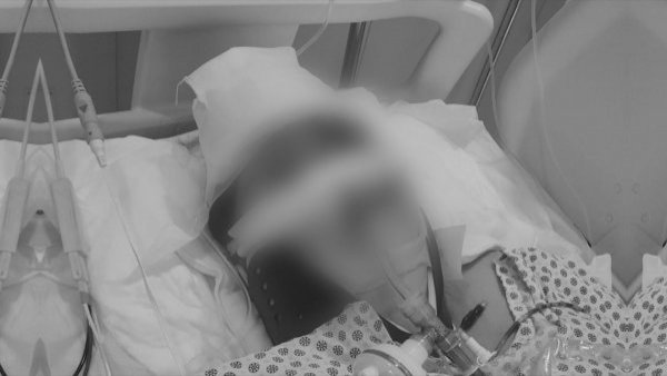Región del Maule: mujer está grave tras recibir un piedrazo en su auto
