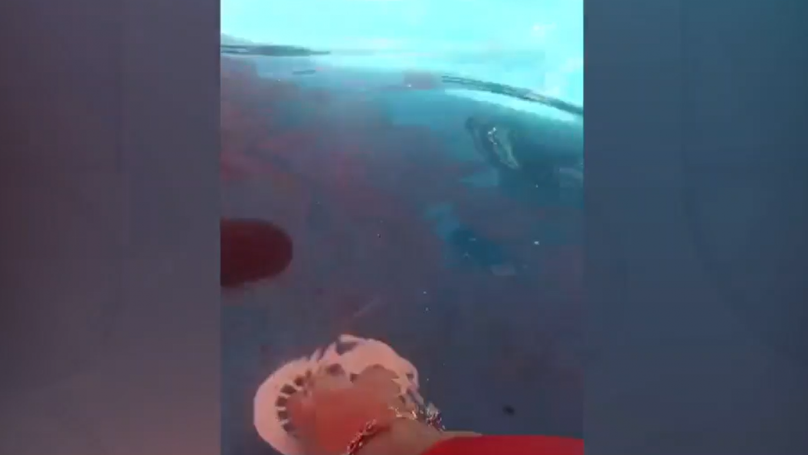 Lo sacaron porque se lo roban: Niña de tres años fue succionada por piscina sin tapón
