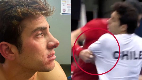 Cristian Garin cae en Copa Davis: fue descalificado tras sufrir agresión de Bergs
