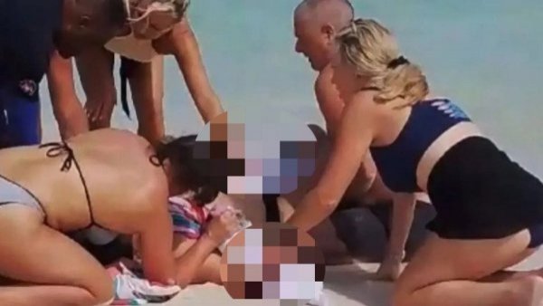 Mujer quiso tomarse una foto con un tiburón, pero sufrió la amputación de ambas manos
