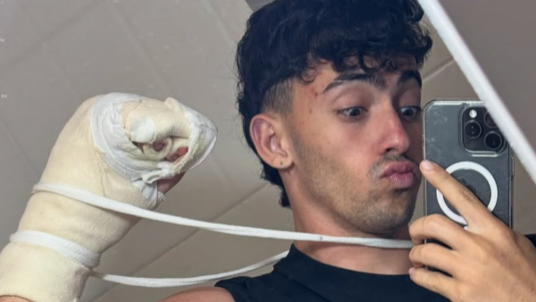"El peor accidente de mi vida": Influencer argentino sufre la mutilación de dos dedos
