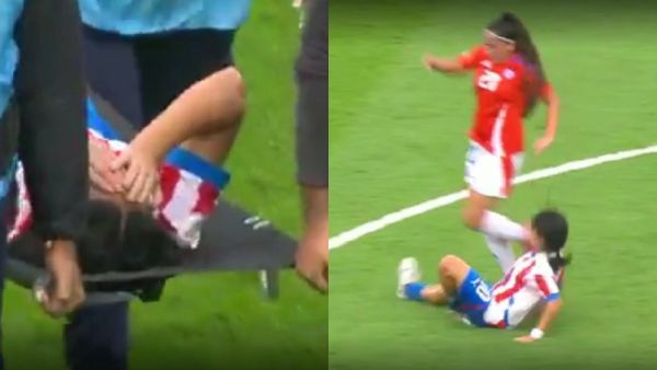 Jugadora de Paraguay sufrió escalofriante lesión ante Chile en el Conmebol Sub 17 Femenino
