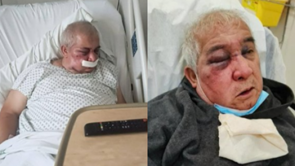 Hijo de conserje agredido entrega detalles del ataque: "Tenía la cara hinchada, sus ojos muy mal"
