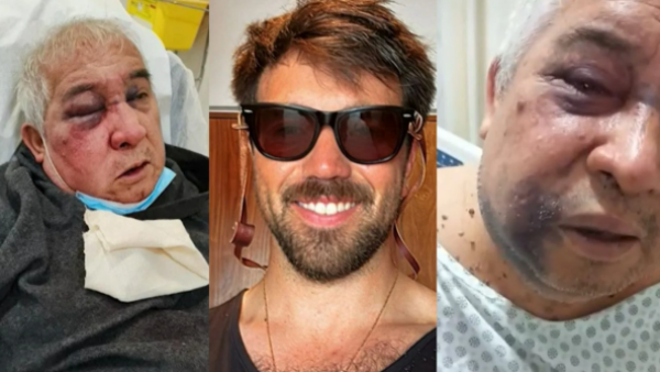 Podría perder su ojo: Conserje recibe violenta golpiza por residente de edificio en Vitacura
