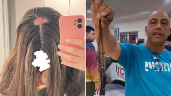 Víctima de quemadura denuncia que peluquería sigue funcionando bajo otro nombre
