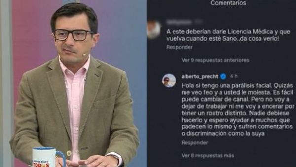El potente mensaje de Alberto Precht tras desubicado comentario por parálisis facial
