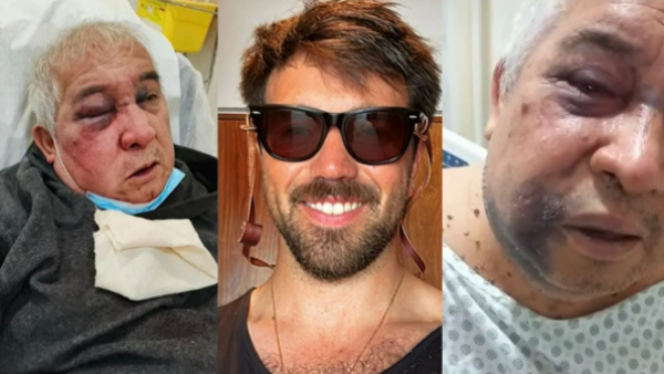 Autor de brutal golpiza contra conserje queda en prisión preventiva
