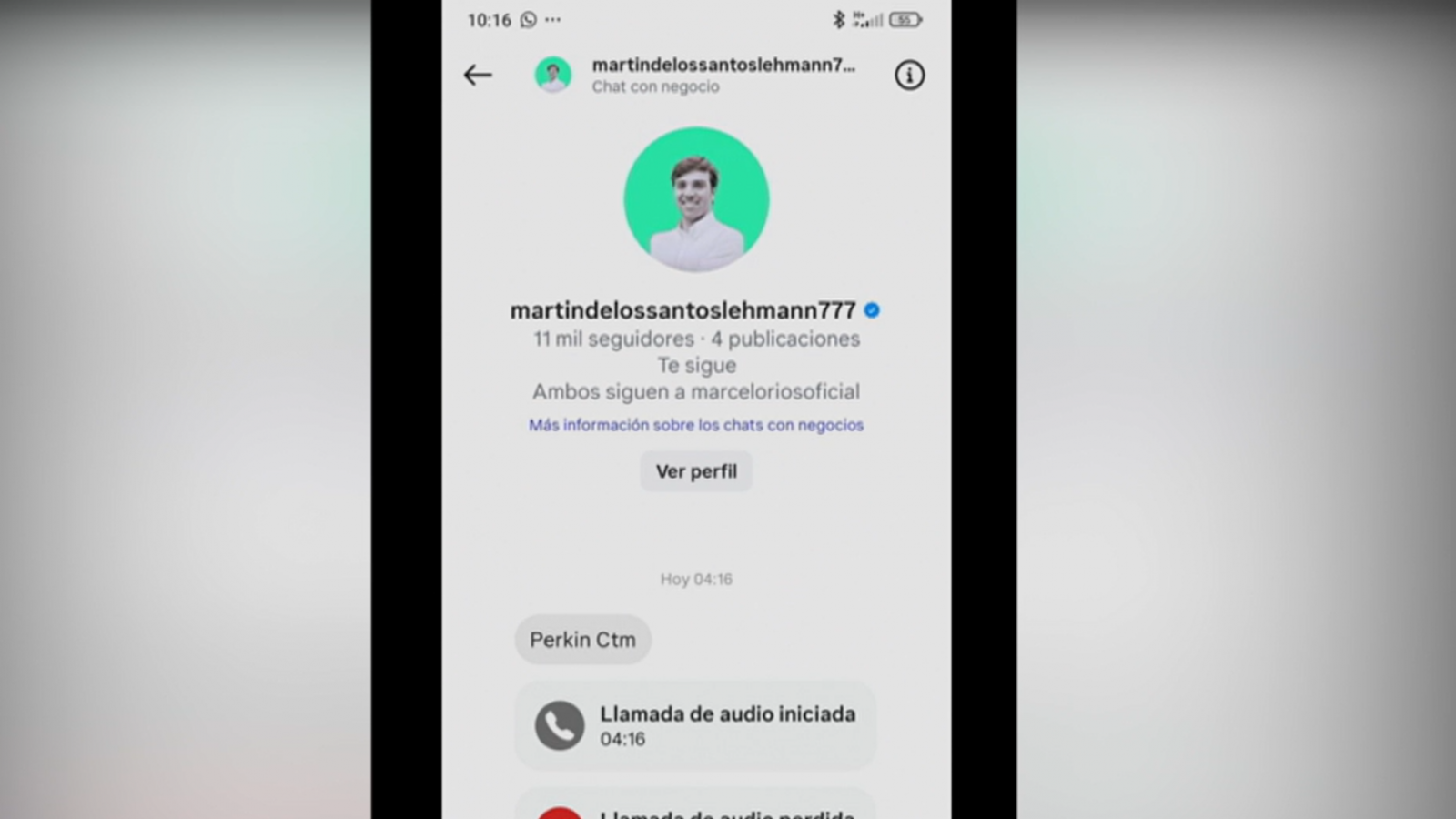 "El tuerto miente": La cruel cuenta de Instagram que creó familiar de Martín de los Santos Lehmann
