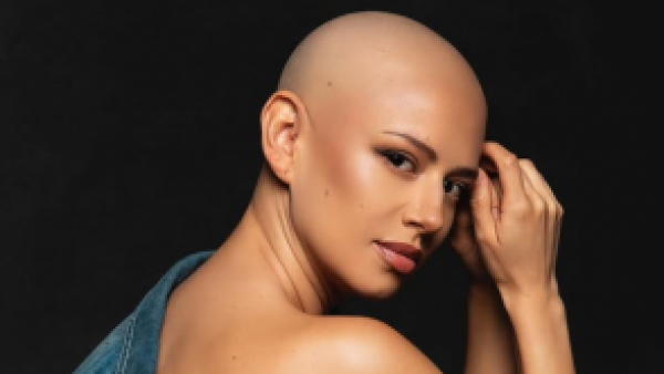 El potente mensaje de Karla Melo tras superar sexta quimioterapia contra el cáncer de mama
