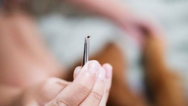 <p>Descubren nuevas bacterias asociadas a garrapatas en el norte de Chile</p>Descubren nuevas bacterias asociadas a garrapatas en el norte de Chile
