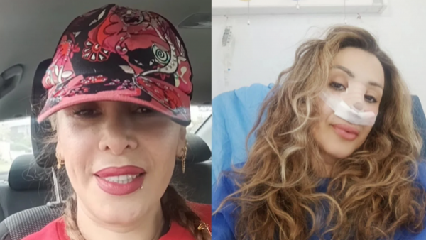 "Oren por mí": Romina Sáez comparte inédita foto de su rostro desfigurado en la previa del juicio por brutal golpiza
