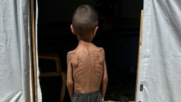 Israel asegura que "la mayoría de las muertes" por hambre en Gaza son por "enfermedades previas"
