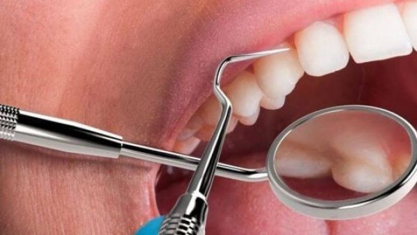 Problemas en las encías: uno de los síntomas que más se ve en consultas

