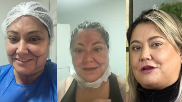 <p>Denisse Campos se somete a importante cirugía estética: busca regresar a la TV</p>Denisse Campos se somete a importante cirugía estética: busca regresar a la TV
