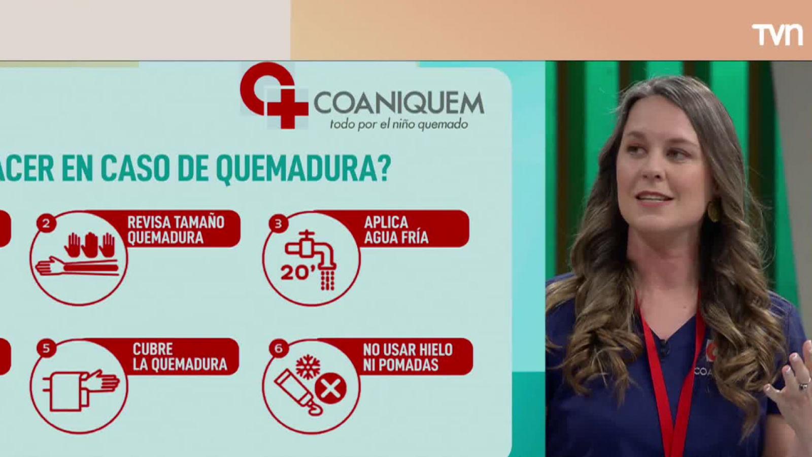 ¿Cómo prevenir y actuar frente a una quemadura en Fiestas Patrias?
