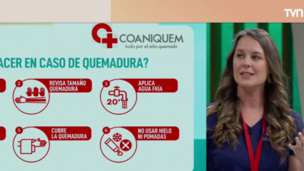 ¿Cómo prevenir y actuar frente a una quemadura en Fiestas Patrias?
