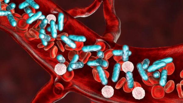 Sepsis: cómo actuar rápido frente a una infección generalizada
