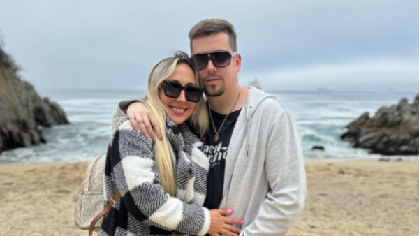 Así quedó el rostro de pareja de Nano Calderón tras protagonizar accidente en moto