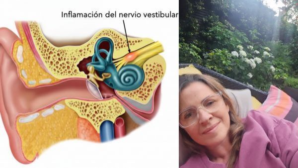 ¿Qué es la neuritis vestibular?: La afección que mantiene con reposo a Monserrat Álvarez
