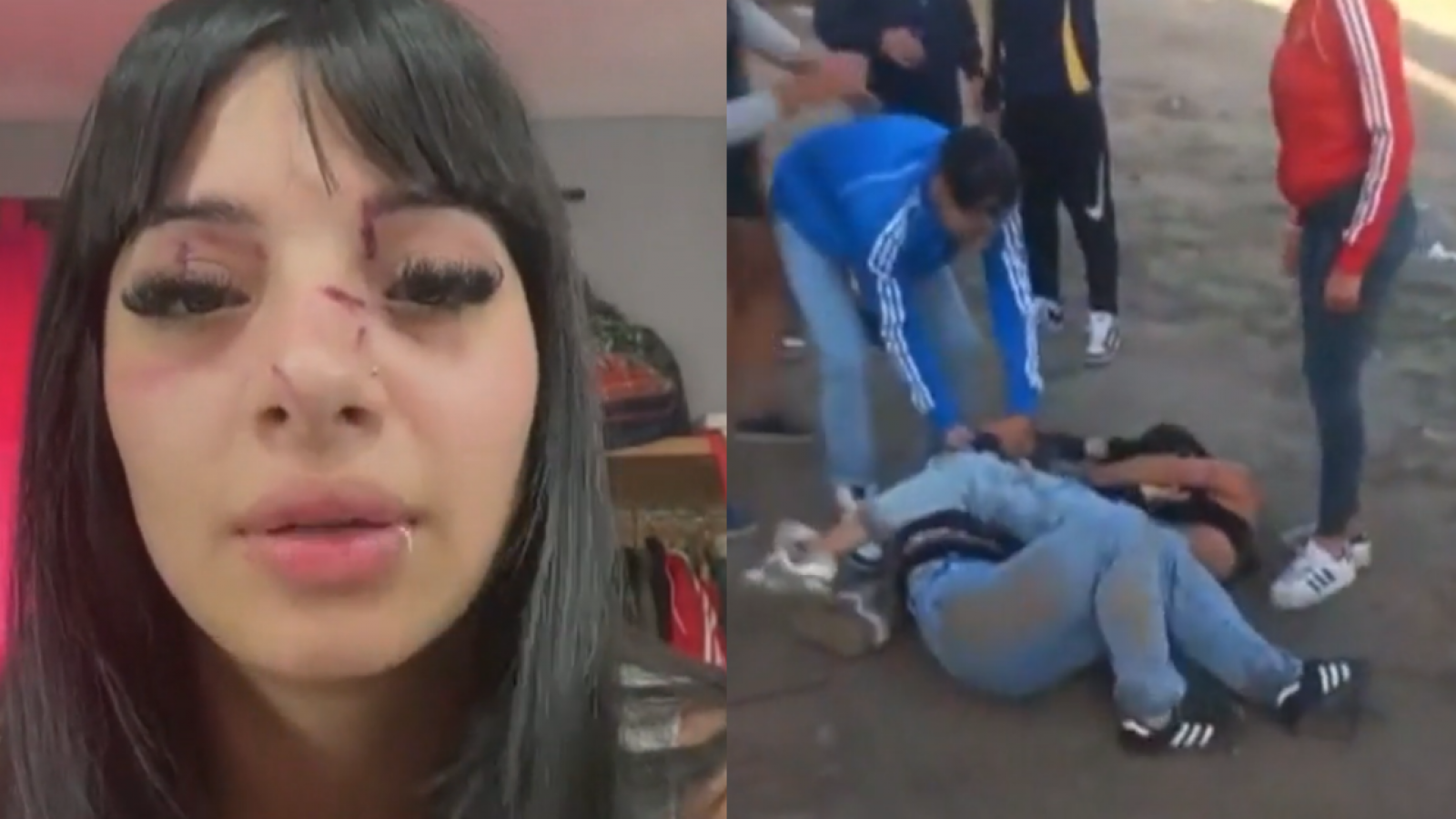 Joven de 18 años es brutalmente golpeada por ocho personas a la salida de un boliche en Argentina