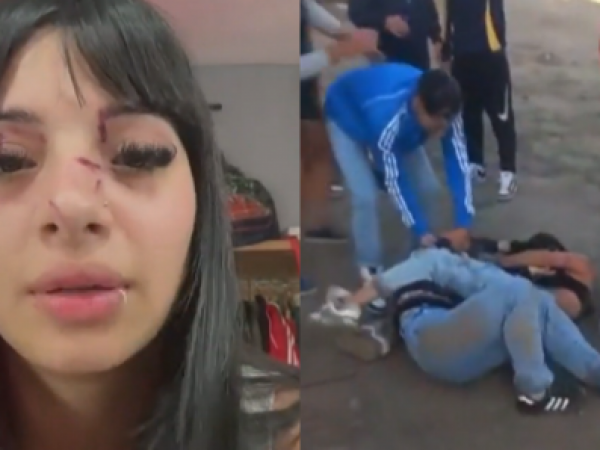 Joven de 18 años es brutalmente golpeada por ocho personas a la salida de un boliche en Argentina