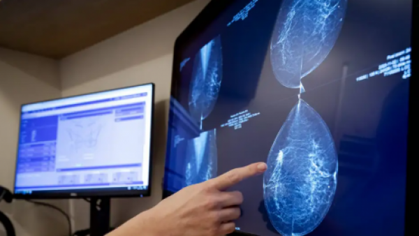 <p>Cáncer de mama: la IA revela lo invisible para los médicos</p>Cáncer de mama: la IA revela lo invisible para los médicos
