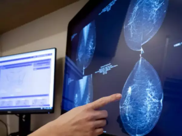 Cáncer de mama: la IA revela lo invisible para los médicos