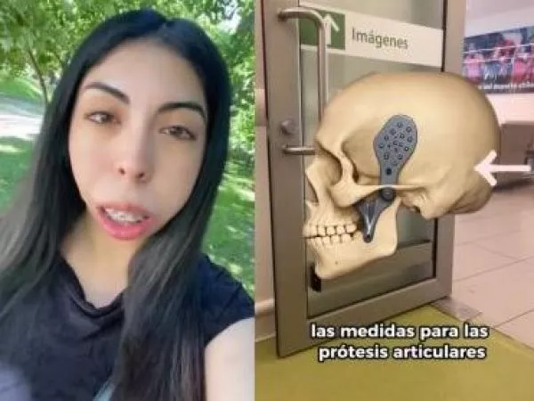 tres imágenes de una joven con malformación en su mandíbula