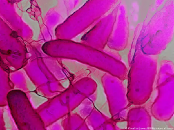 El raro síndrome intestinal que emborracha sin beber alcohol