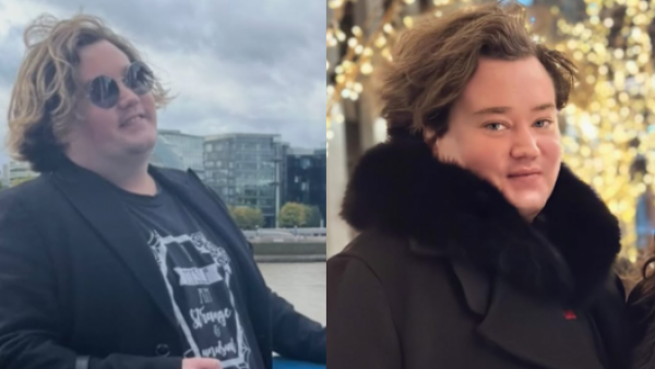 <p>Bajó 40 kilos: el antes y después de Nicolás Yunge tras radical cambio físico</p>Bajó 40 kilos: el antes y después de Nicolás Yunge tras radical cambio físico
