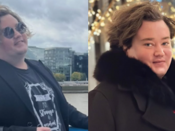 Bajó 40 kilos: el antes y después de Nicolás Yunge tras radical cambio físico