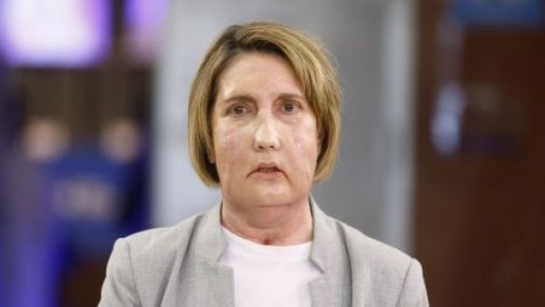 <p>Los detalles del primer trasplante facial del mundo con un donante que accedió a la eutanasia</p>Los detalles del primer trasplante facial del mundo con un donante que accedió a la eutanasia
