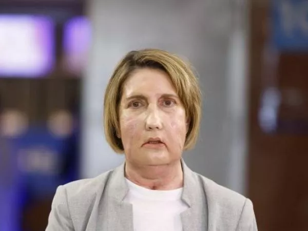 Los detalles del primer trasplante facial del mundo con un donante que accedió a la eutanasia