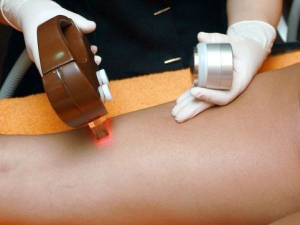 Mujeres denuncian difusión de imágenes de depilación íntima en páginas porno