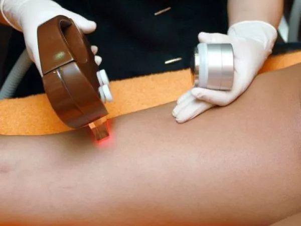 Mujeres denuncian difusión de imágenes de depilación íntima en páginas porno