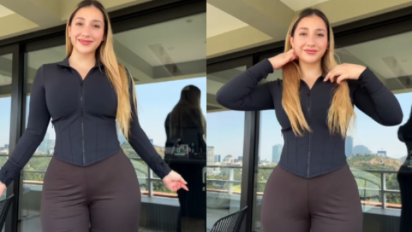 La reflexión de Carlita tras someterse a cirugía estética