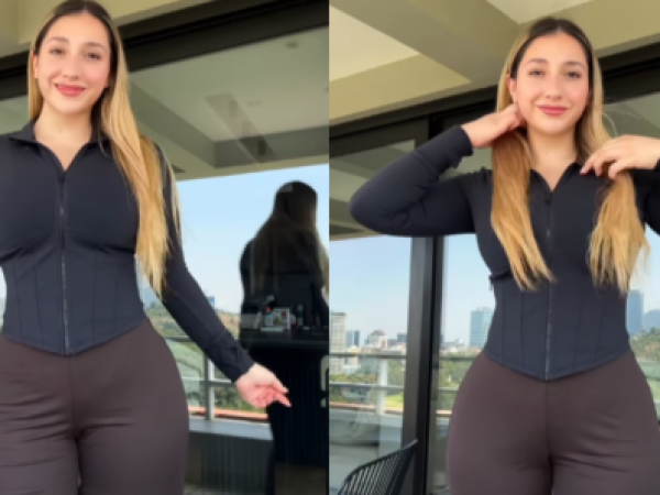 La reflexión de Carlita tras someterse a cirugía estética