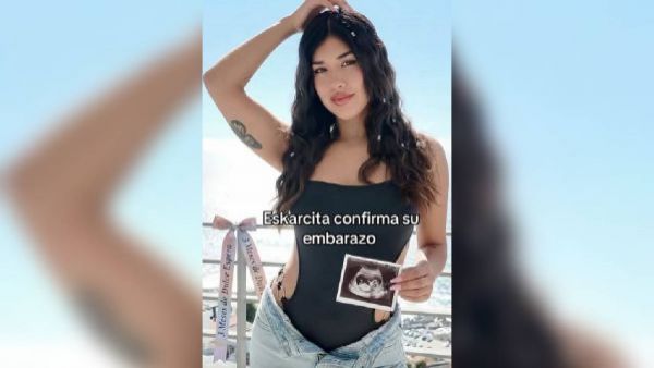 La aclaración de Eskarcita tras especulaciones sobre un supuesto embarazo
