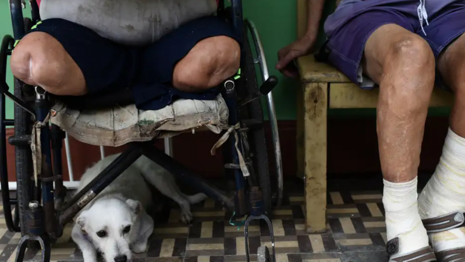 Chile es el primer país de América libre de lepra