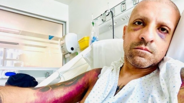 <p>Caso Rodrigo Rojas Vade: investigación sugiere que pudo tratarse de un auto-ataque</p>Caso Rodrigo Rojas Vade: investigación sugiere que pudo tratarse de un auto-ataque
