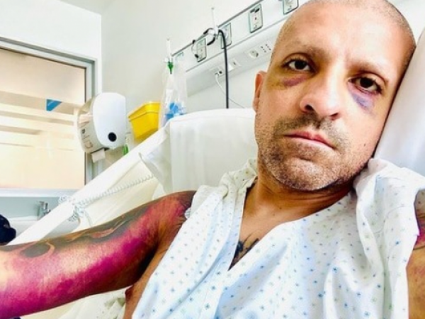 Caso Rodrigo Rojas Vade: investigación sugiere que pudo tratarse de un auto-ataque