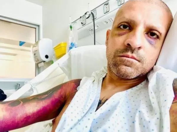 Caso Rodrigo Rojas Vade: investigación sugiere que pudo tratarse de un auto-ataque