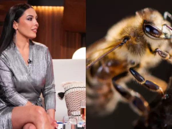Así quedó el rostro de Daniela Aránguiz tras sufrir una picadura de abeja