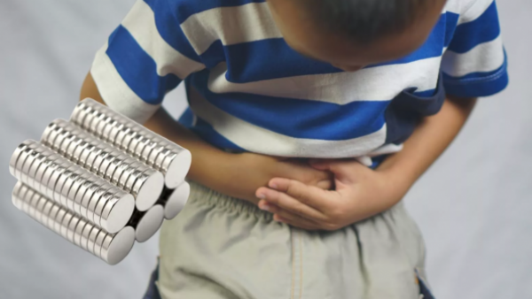 Médicos advierten graves riesgos en niños y adolescentes en reto viral con imanes
