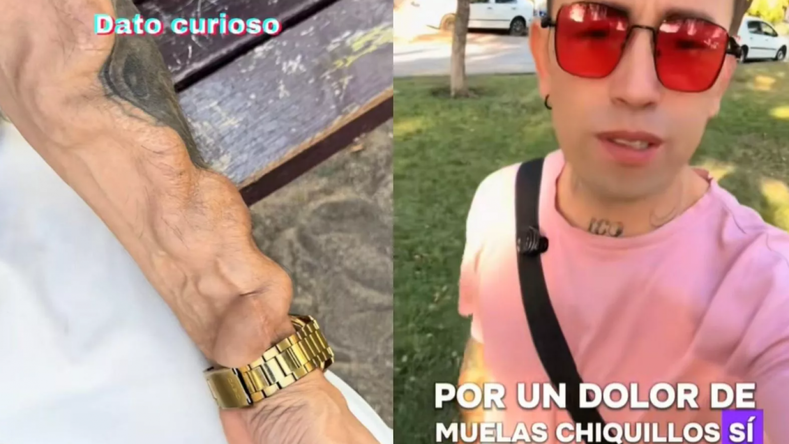 Odontólogo detalla por qué joven terminó con diálisis tras extracción de muela

