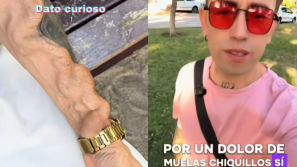 Odontólogo detalla por qué joven terminó con diálisis tras extracción de muela
