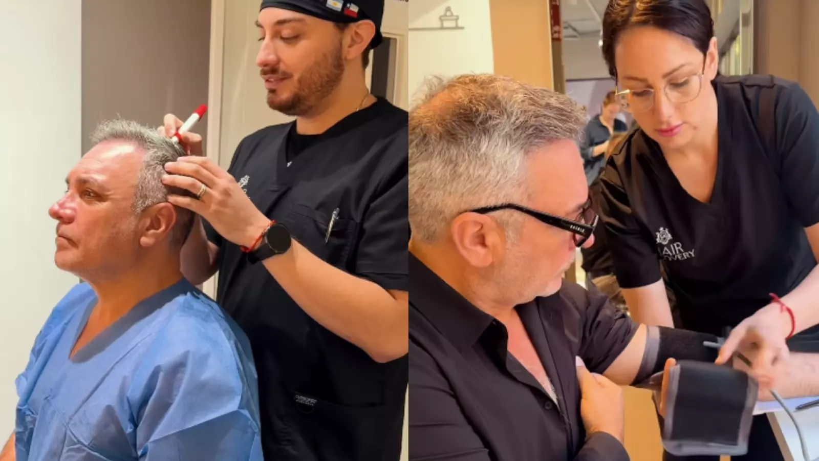 Así fue el procedimiento capilar al que se sometió Luis Jara