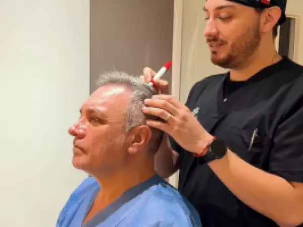 Así fue el procedimiento capilar al que se sometió Luis Jara