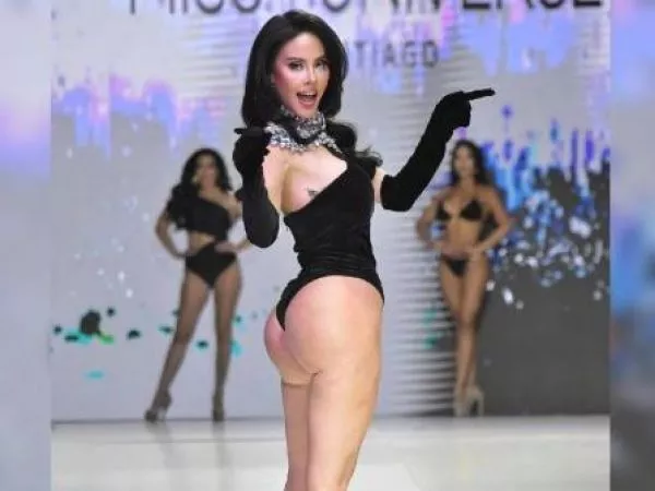 Ignacia Michelson reveló secuelas tras inyectarse biopolímeros